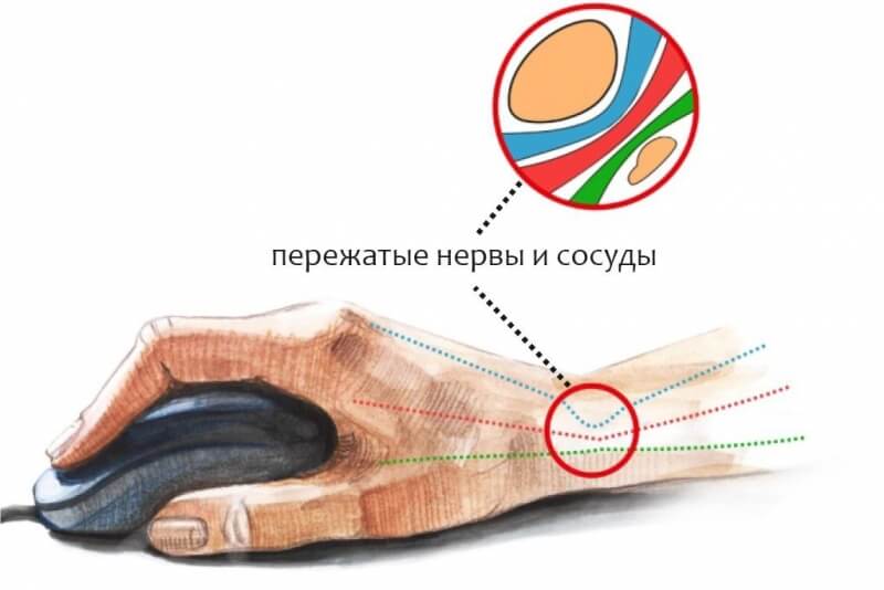 Работает ли кракен